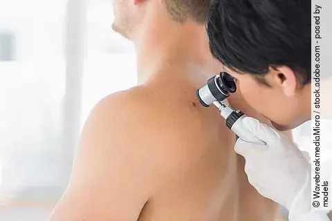 Hautkrebsscreening unter der Lupe