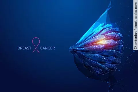 Abstrakte, polygonale Darstellung einer Brust in Blau- und Orangetönen mit vernetzten Linien und Lichtpunkten, daneben ein rosa Band und der Schriftzug „Breast Cancer“.
