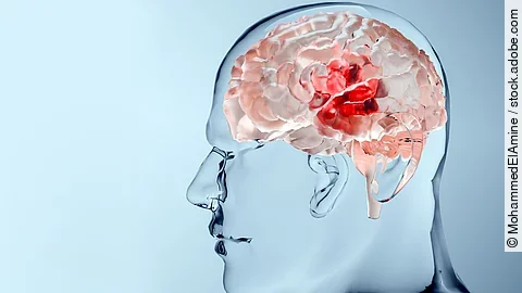 Human brain nervous system anatomy, neural cancer, Sebaceous bulb, brain cancer tumor malignant cells growth and spreading, Meningioma, neurological disease, metastasis cancerous, cerebrum, 3d render