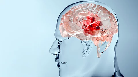 Hirnmetastasen zeigen auffällige Kombinationen genetischer Veränderungen Human brain nervous system anatomy, neural cancer, Sebaceous bulb, brain cancer tumor malignant cells growth and spreading, Meningioma, neurological disease, metastasis cancerous, cerebrum, 3d render