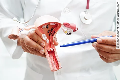 Uterus, doctor holding anatomy model for study diagnosis and treatment in hospital.