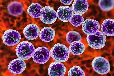 Burkitt's lymphoma cells, is a cancer of the lymphatic system