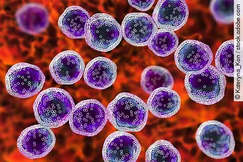 Burkitt's lymphoma cells, is a cancer of the lymphatic system