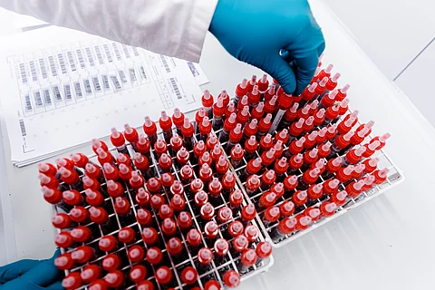 Ein Mitarbeiter eines Labors beschriftet Gewebeproben vor deren Analyse mit einem Barcode. 