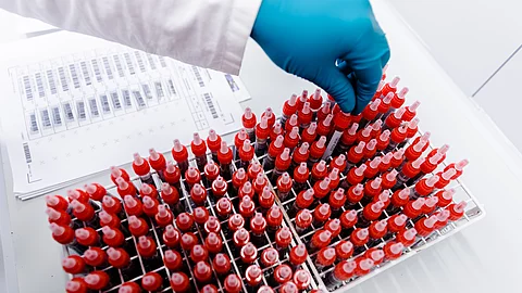 Ein Mitarbeiter eines Labors beschriftet Gewebeproben vor deren Analyse mit einem Barcode. Ein Mitarbeiter eines Labors beschriftet Gewebeproben vor deren Analyse mit einem Barcode.