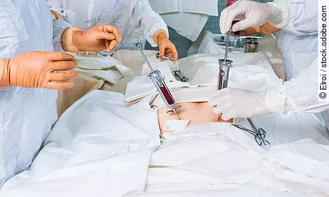 bone marrow transplant operation