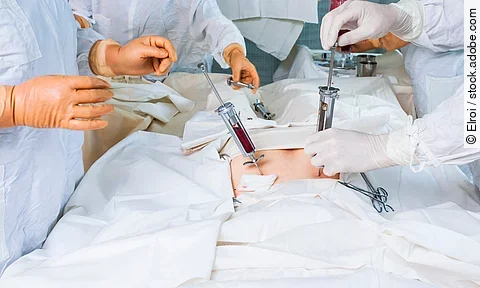 bone marrow transplant operation