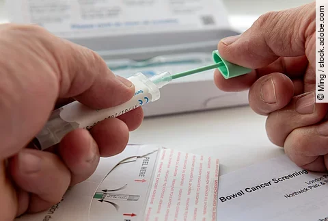 London. UK- 04.17.2024. A person putting the bowel cancer test sample in the sample holder before sending it off by mail for testing.