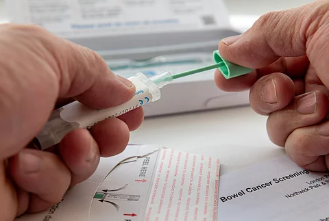 FIT-Stuhltest zum Darmkrebsscreening