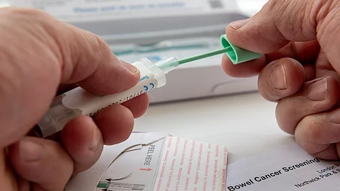 Person legt eine Probe für einen FIT-Stuhltest in einen Behälter, um sie per Post zur Untersuchung einzusenden.