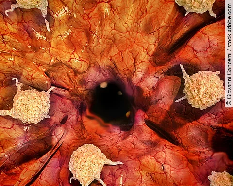 Cancer cells, 3d illustration