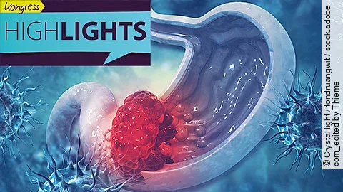 Grafische Darstellung eines Magens mit Tumor, umgeben von Immunzellen