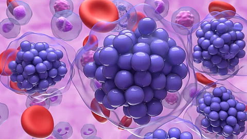 Diffuses großzelliges B-Zell-Lymphom (DLBCL) – 3D-Illustration