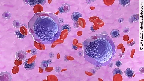 Akute myeloische Leukämie (AML)-Zellen im Blutkreislauf – isometrische Ansicht