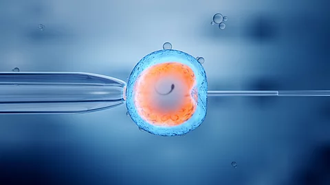 Intrazytoplasmatische Spermieninjektion (ICSI): ein einzelnes Spermium wird direkt in eine Eizelle injiziert.