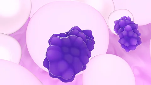 Liposarkom – Nahaufnahme, 3D-Darstellung