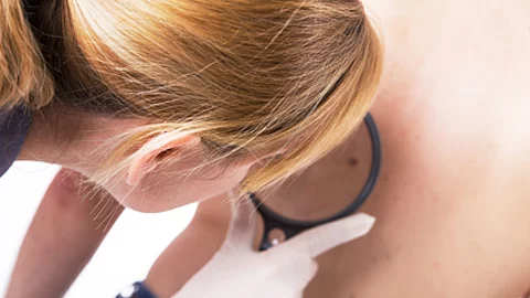Eine Dermatologin untersucht mit einem Dermatoskop eine Hautstelle am Rücken einer Patientin im Rahmen eines Hautkrebsscreenings.