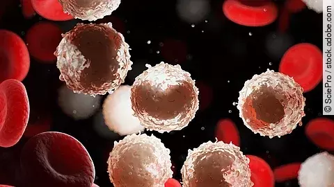 Illustrative 3D‑Darstellung von Lymphozyten im Blut bei chronischer lymphatischer Leukämie (CLL)