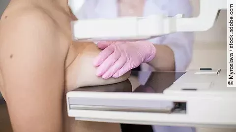 Mammografie: Eine Person steht vor einem Gerät, während eine medizinische Fachkraft die Brust für die Röntgenaufnahme positioniert.