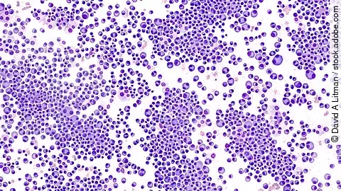 Mikroskopische Aufnahme von Knochenmarkzellen – typische Zellstrukturen, wie sie bei der Diagnose des multiplen Myeloms untersucht werden.