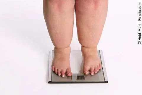 Adipöse Frau steht auf der Waage