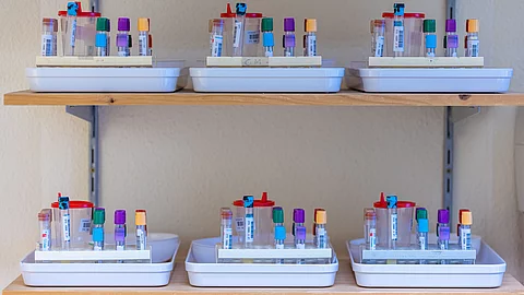 Probenröhrchen verschiedener Untersuchungen stehen in Labortrays bereit – sie gehören zu den vielfältigen diagnostischen Verfahren der SHIP‑Studie
