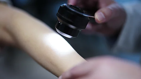 Ein medizinisches Gerät zur Hautuntersuchung wird nah an die Haut eines Arms gehalten, um eine verdächtige Stelle zu prüfen.