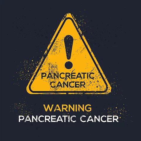 Achtung Pankreaskarzinom: Zwei neue Bluttests könnten die Früherkennung von Pankreaskarzinomen bei Risikopatienten verbessern Achtung Pankreaskarzinom: Zwei neue Bluttests könnten die Früherkennung von Pankreaskarzinomen bei Risikopatienten verbessern