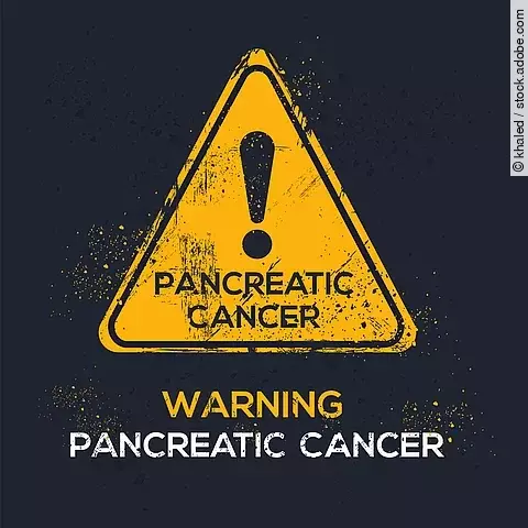 Achtung Pankreaskarzinom: Zwei neue Bluttests könnten die Früherkennung von Pankreaskarzinomen bei Risikopatienten verbessern 