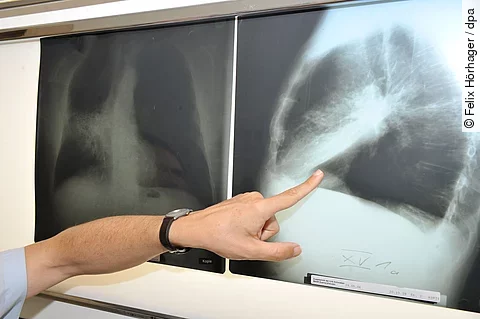 urn:newsml:dpa.com:20090101:250627-935-677069