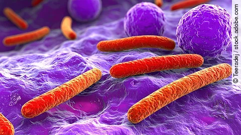 Mikroskopische Aufnahme von Fusobakterien assoziiert mit Krebszellen im Darm Mikroskopische Aufnahme von Fusobakterien assoziiert mit Krebszellen im Darm
