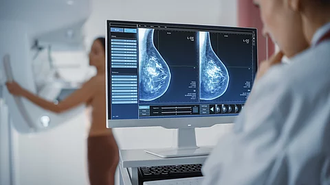 Eine Radiologin sitzt vor mehreren Monitoren in einem Krankenhaus und betrachtet Mammografie‑Aufnahmen.