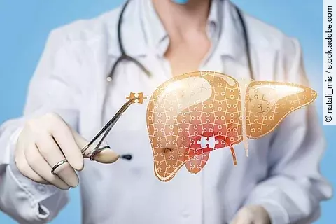 Arzt operiert Leber (Symbolbild)