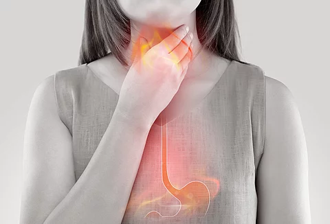 Woman Suffering From Acid Reflux Or Heartburn-Isolated On White 