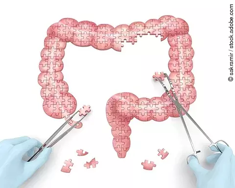 Large intestine puzzle concept