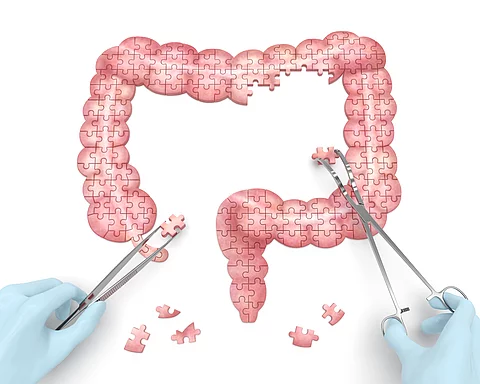 Large intestine puzzle concept