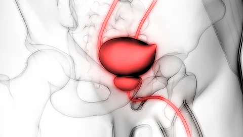 Schematische medizinische Illustration des männlichen Beckens mit rot hervorgehobener Prostata.