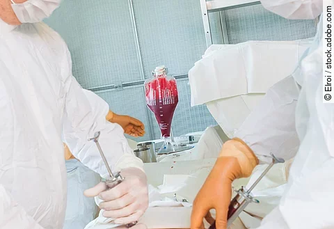 bone marrow transplant operation