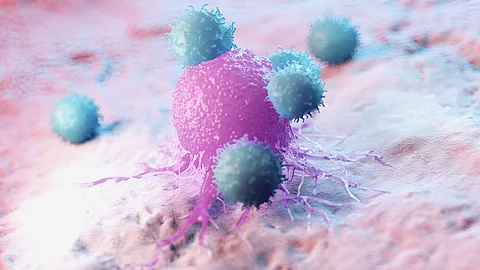 Immunzelldichte im Tumorgewebe - ein wichtiger Faktor für Risiko und Prognose