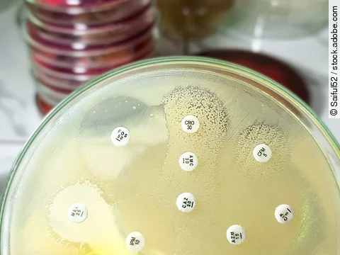 Antibiotic susceptibility testing,  antibiotic resistance.